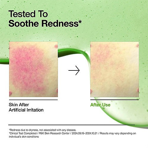 Anua - Azelaic Acid 10 Hyaluron Redness Soothing Serum سيروم الحبوب والاحمرار 💚