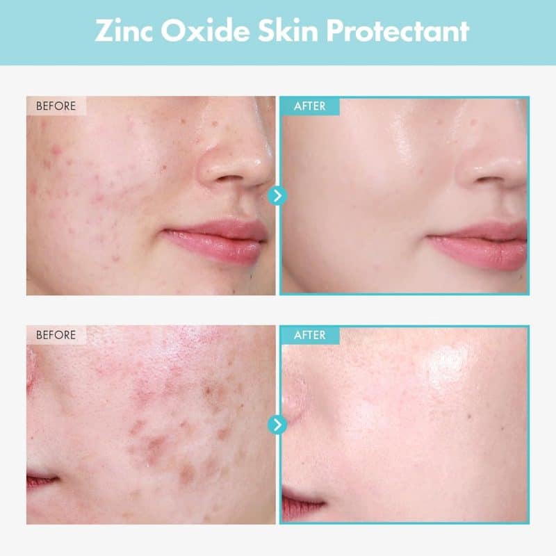 TOSOWOONG - SOS Repair Cica Clinic Zinc Oxide 10% Cream