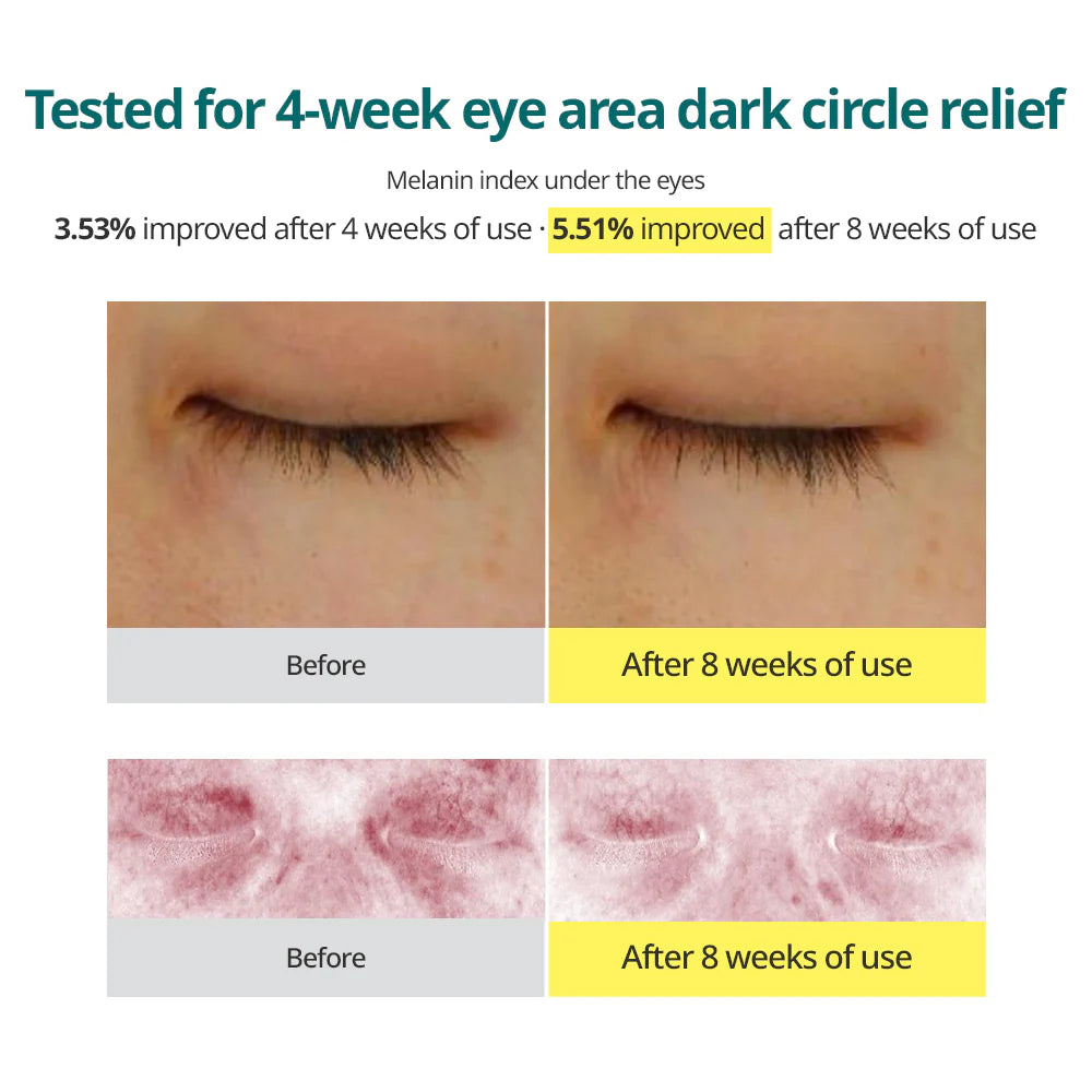 GOODAL - Green Tangerine Vita C Dark Circle Eye Cream